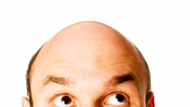 Thinning on top? Then you might want to enter our Bioxsine competition   [COMPETITION CLOSED]