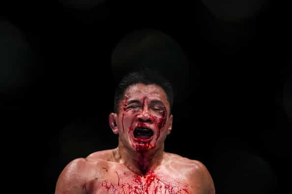 Pic: UFC fighter tests positive for PED’s and when you see the photos you will see why…