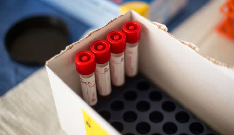 102 new cases of Covid-19 confirmed in Ireland