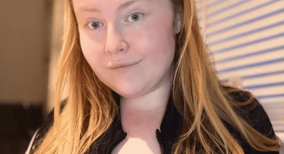 Woman with double N-cup boobs say they won’t stop growing due to rare condition