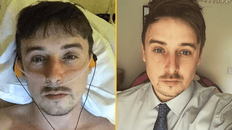 Man becomes father after having four inches of penis amputated