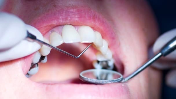 Sugar and teeth: What’s the big problem?