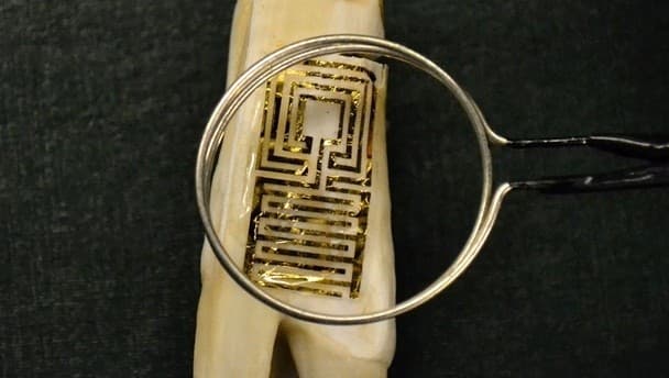 A “tooth tattoo” that could save your life