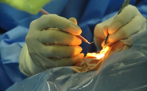 Extreme cheapskate – man to sell his testicle for new reality TV show