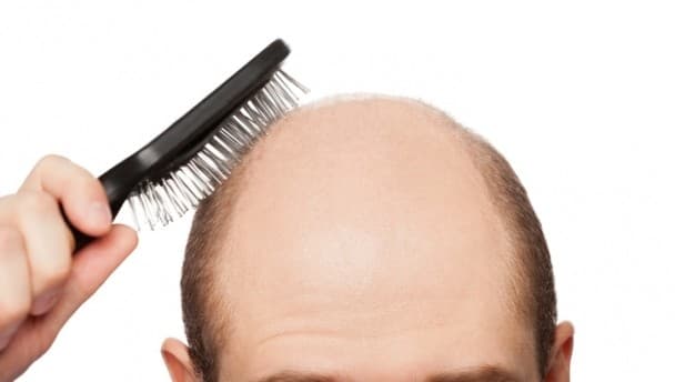Hair Today Gone Tomorrow: JOE takes a look at receding hairlines and how LLLT technology could help…
