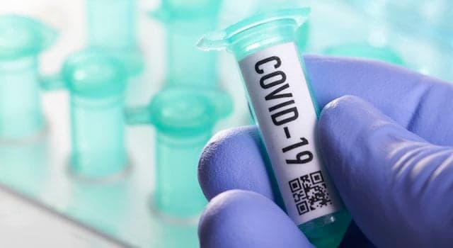 Three further deaths and 302 new cases of Covid-19 confirmed in Ireland