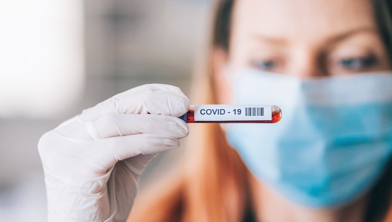 Five Covid-19 deaths, 322 new cases confirmed