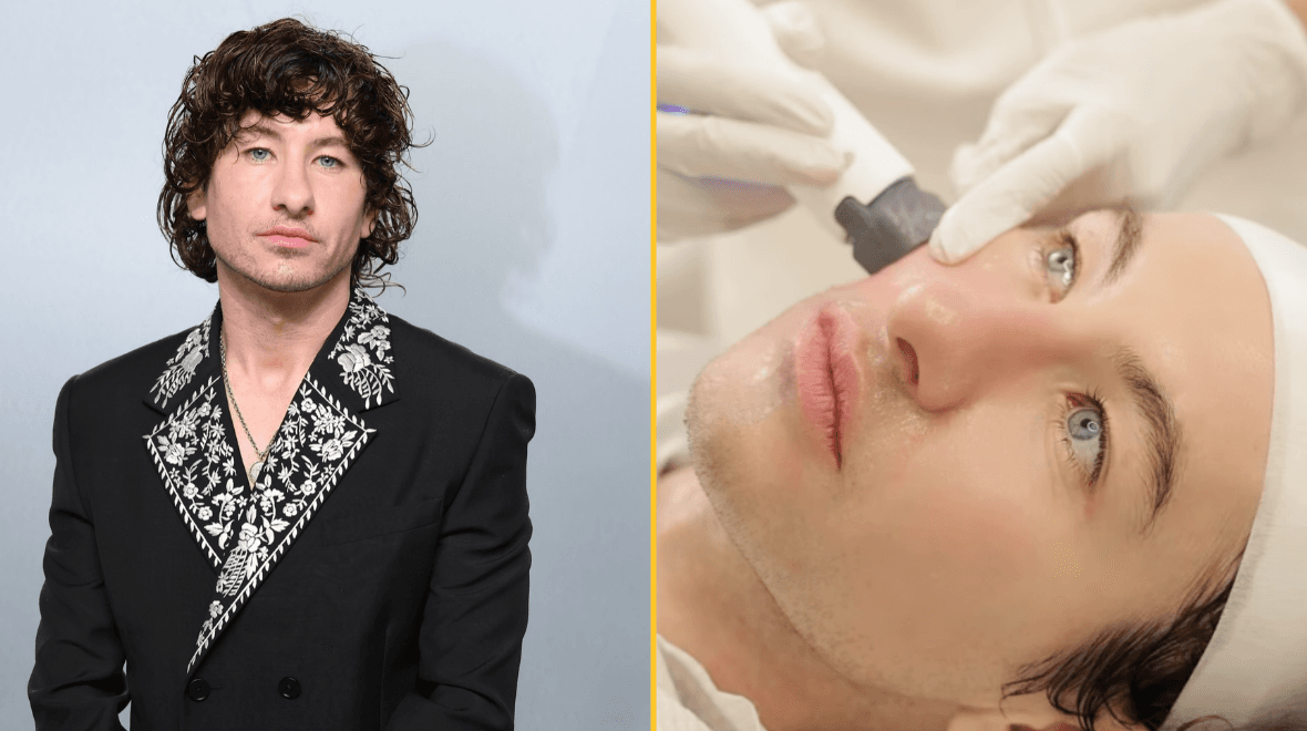 Barry Keoghan admits undergoing cosmetic treatment after online abuse