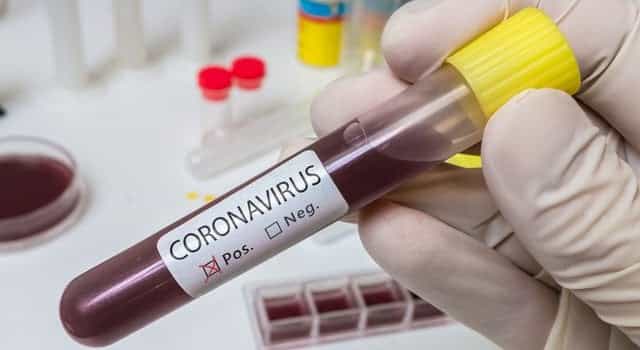 69 new confirmed cases of Covid-19 in Ireland 69 new confirmed cases of Covid-19 in Ireland