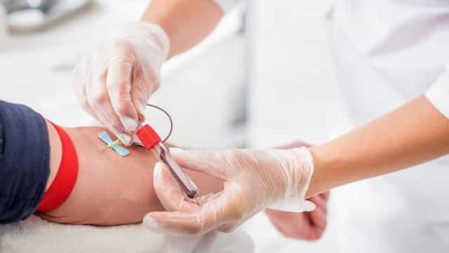 Restrictions for gay and bisexual men to give blood set to ease Restrictions for gay and bisexual men to give blood set to ease