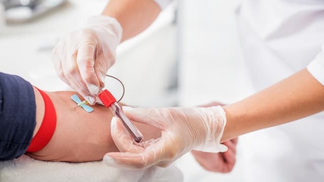 Restrictions for gay and bisexual men to give blood set to ease Restrictions for gay and bisexual men to give blood set to ease