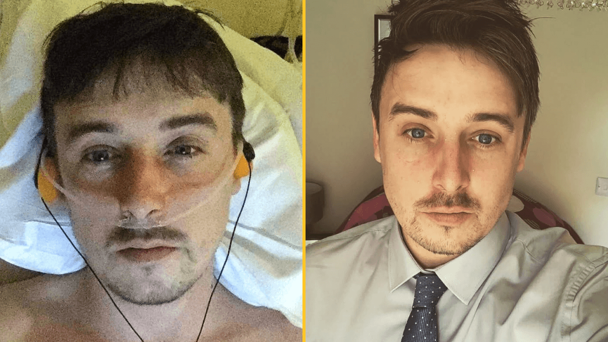 Man becomes father after having four inches of penis amputated