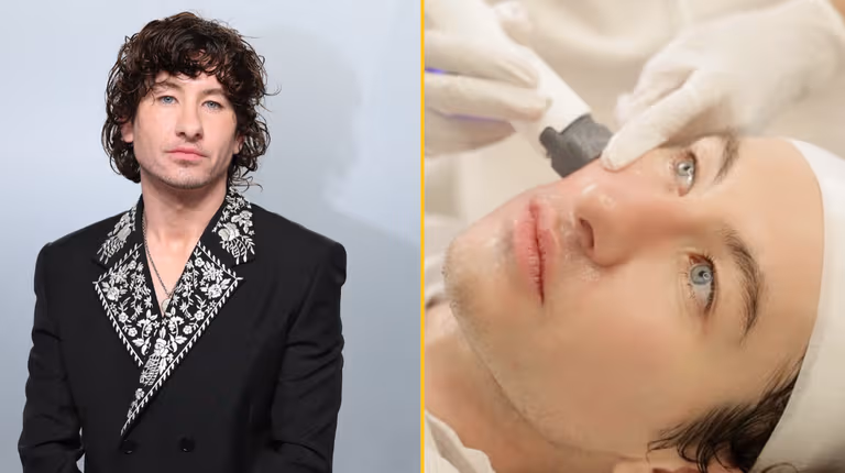 Barry Keoghan admits undergoing cosmetic treatment after online abuse Barry Keoghan admits undergoing cosmetic treatment after online abuse