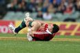 Lions Pic of the Day: Here is the current state of Cian Healy’s ankle