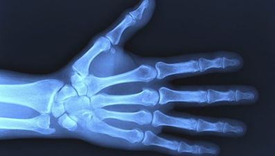 Gallery: More shocking X-ray pictures