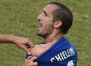 Pic: Giorgio Chiellini has been bitten again but this time it wasn’t Luis Suarez