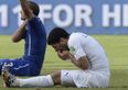 Your search for the best Luis Suarez bite GIF ends here