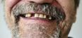 UK study finds that one in four people often go a whole day without brushing their teeth