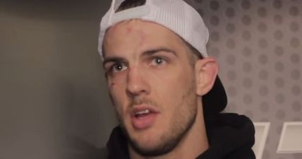 Pic: UFC fighter’s Instagram post reveals a gruesome looking leg infection