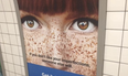 PICS: A lot of people are angry at what this dating website rates as “imperfections”