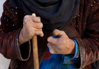 Bacteria that causes leprosy is mutating into something even more dangerous