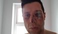 Tyrone GAA release statement following investigation into Sean Cavanagh injuries