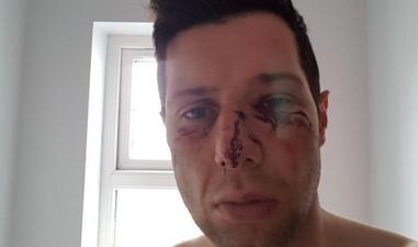 Tyrone GAA release statement following investigation into Sean Cavanagh injuries