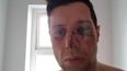 Seán Cavanagh’s club express ‘dismay’ after no action taken following incident in Tyrone club game