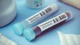 174 new cases of Covid-19 confirmed, one new death