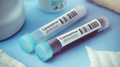 174 new cases of Covid-19 confirmed, one new death
