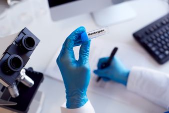 Six confirmed cases of monkeypox have been identified in Ireland