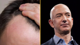 Scientists may have discovered potential cure for baldness