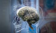 Cause of Alzheimer’s might be coming from inside your mouth, scientists find