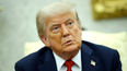 Donald Trump has been diagnosed with chronic venous insufficiency