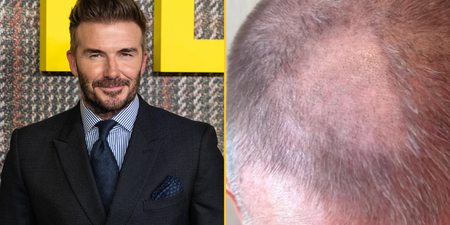 David Beckham left with ‘terrible’ bald patch after trying to cut his own hair