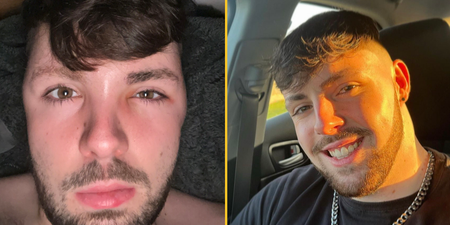 Man who ignored ‘no sex’ advice after hair transplant instantly regrets it