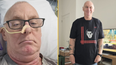 Man diagnosed with throat cancer caused by oral sex
